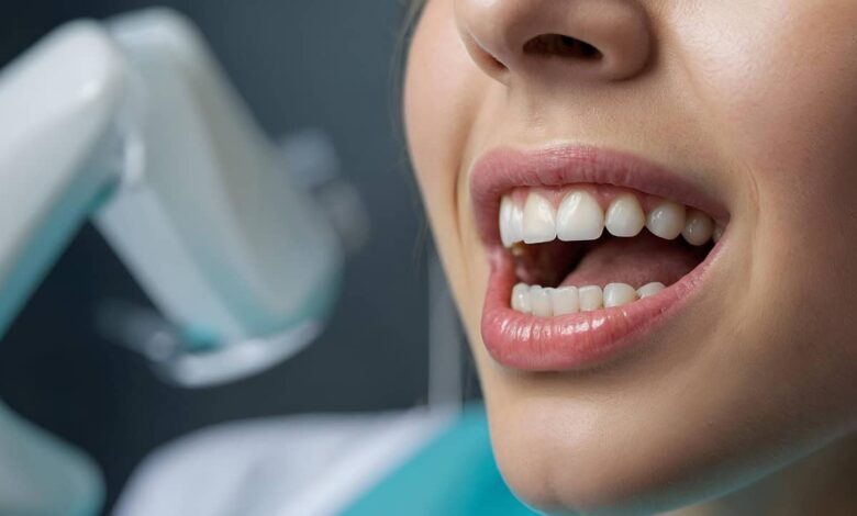 close-up view of a smiling woman’s mouth with clean, white teeth during a dental examination
